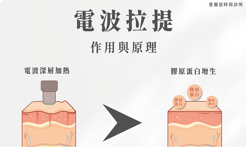 blog_img1