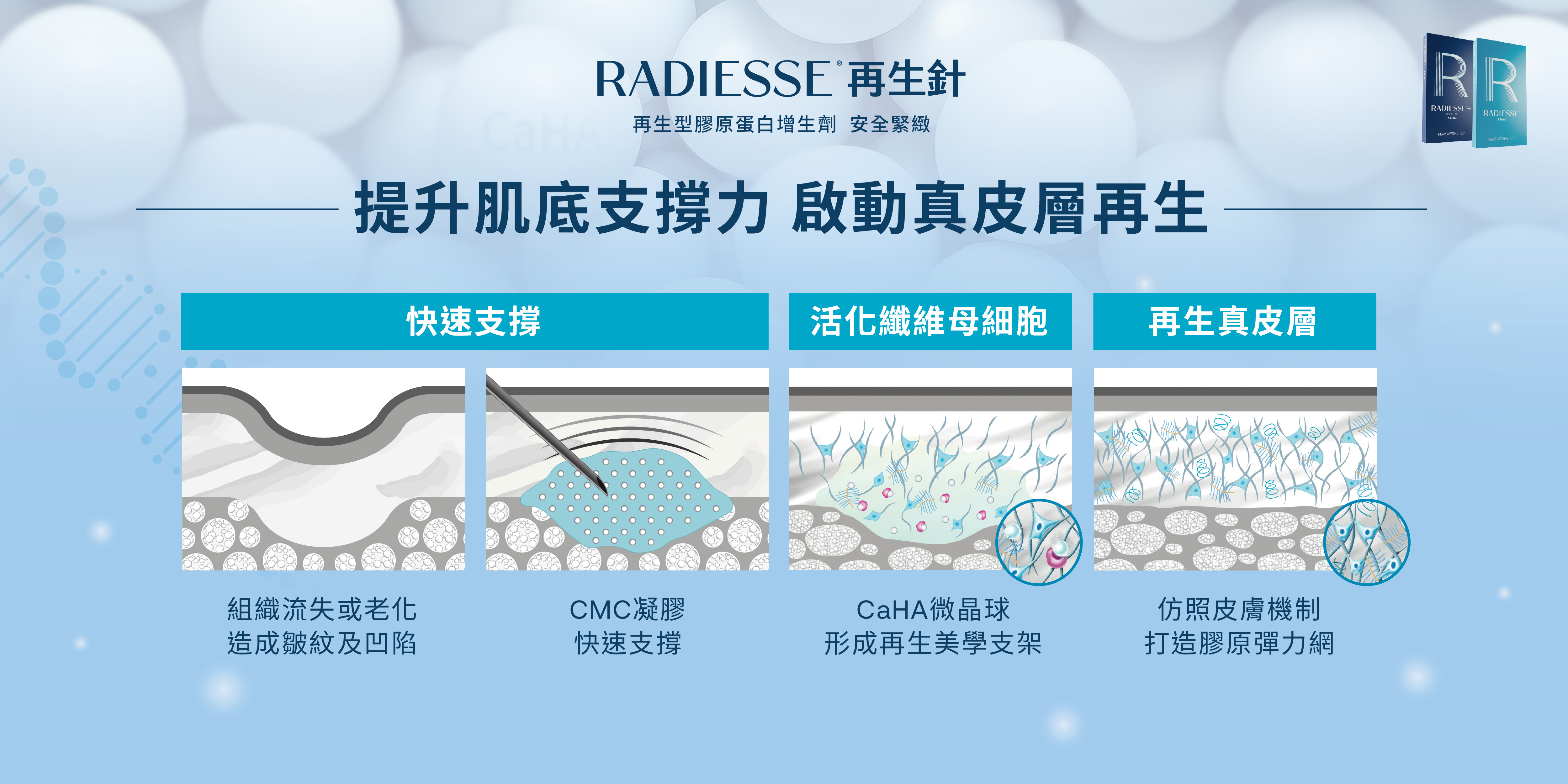 Radiesse 再生針 提升肌底支撐