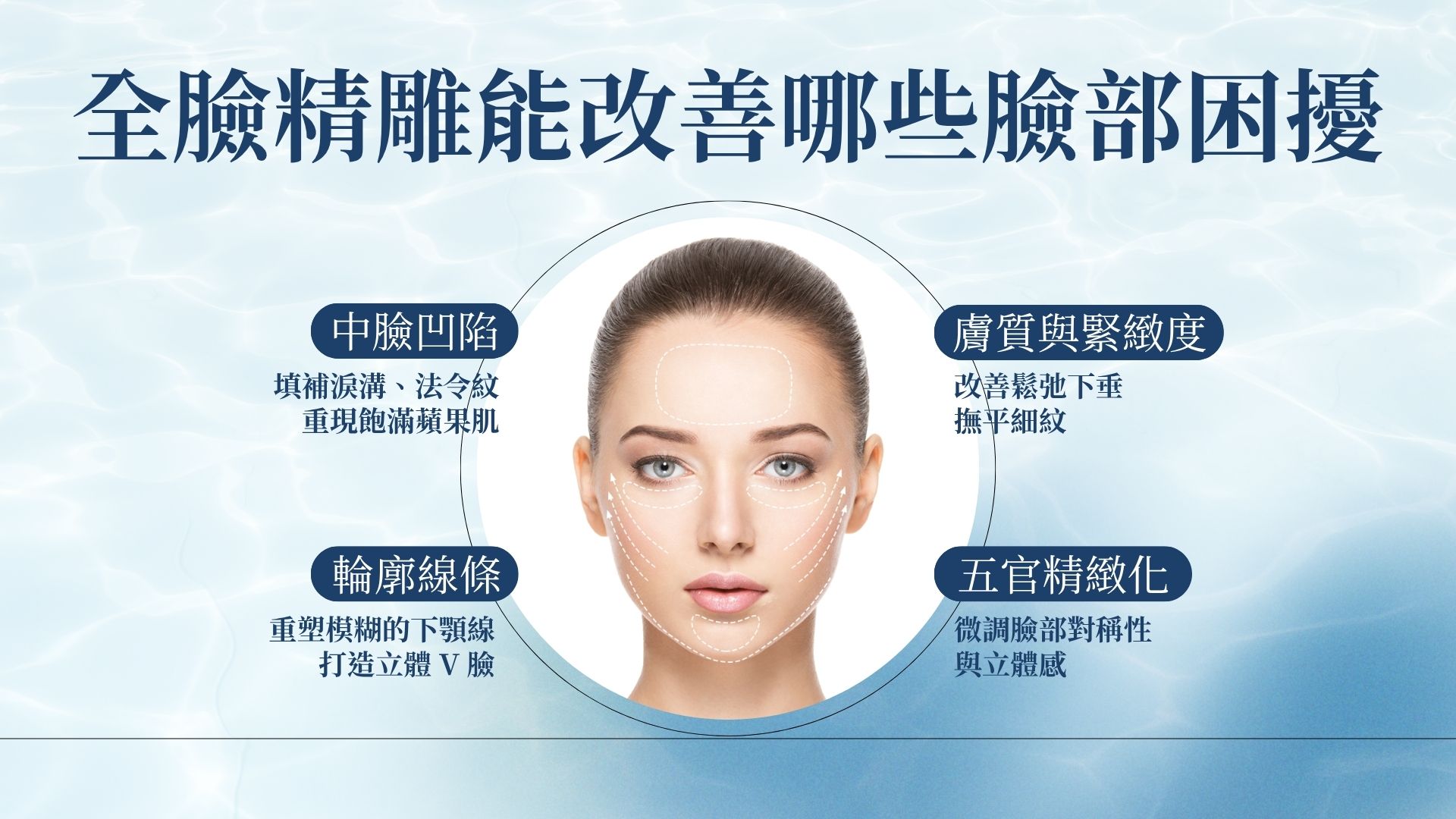 全臉精雕改善什麼