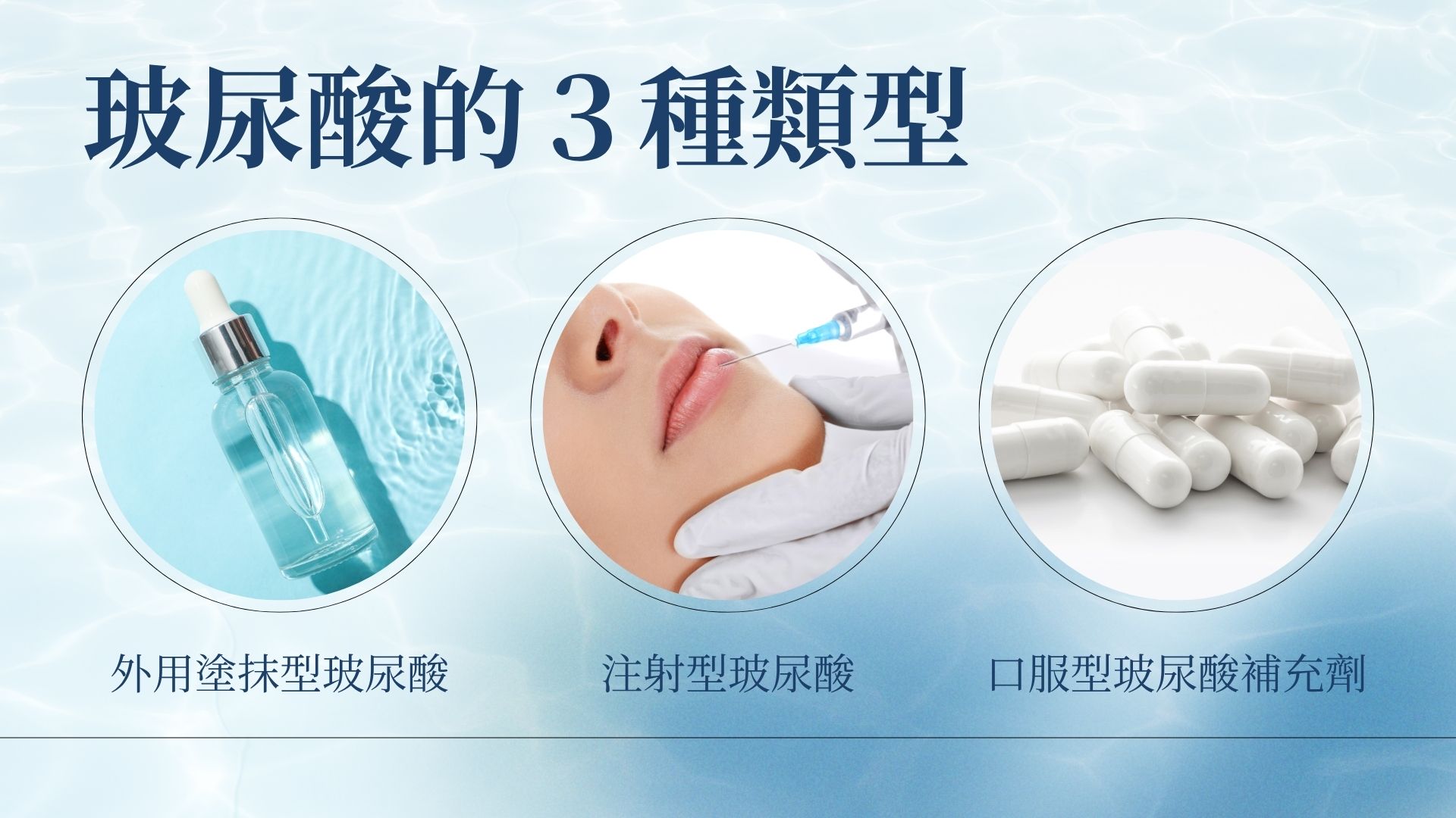 玻尿酸類型