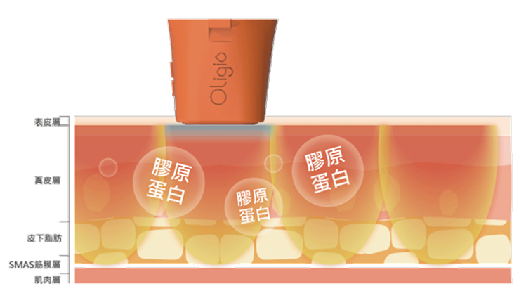 膠原蛋白