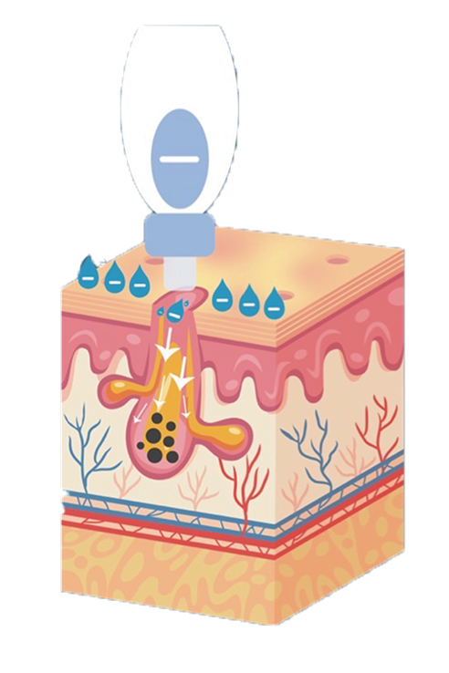 水電滲透模式